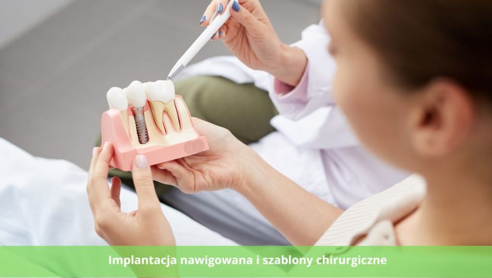 Implantacja nawigowana i szablony chirurgiczne