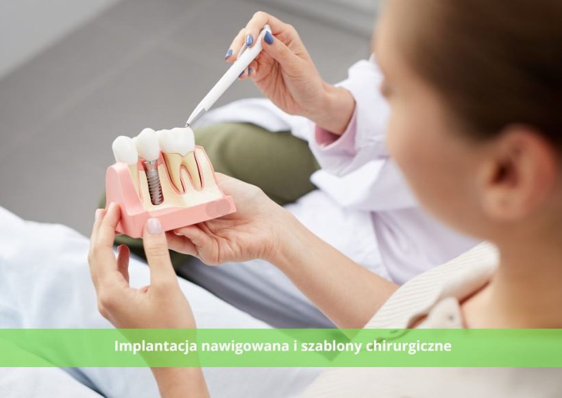 Implantacja nawigowana i szablony chirurgiczne