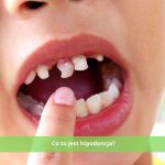 Co to jest hipodoncja? Objawy, przyczyny i leczenie