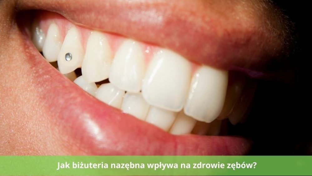 biżuteria nazębna - wpływ na zdrowie zębów