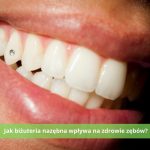 biżuteria nazębna - wpływ na zdrowie zębów