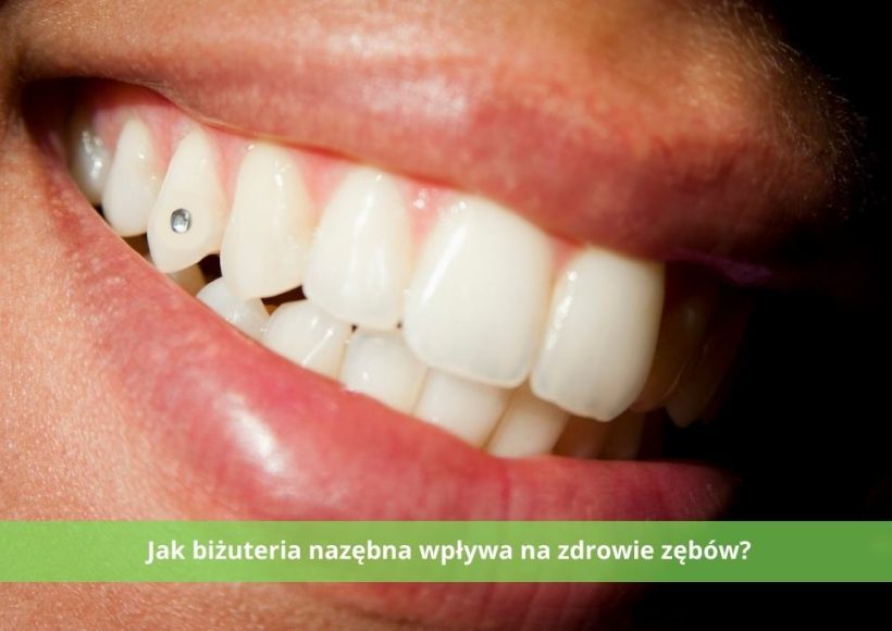 biżuteria nazębna - wpływ na zdrowie zębów