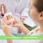 Implanty jednofazowe kontra dwufazowe