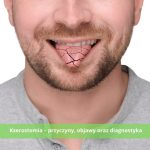 Kserostomia – jakie są przyczyny