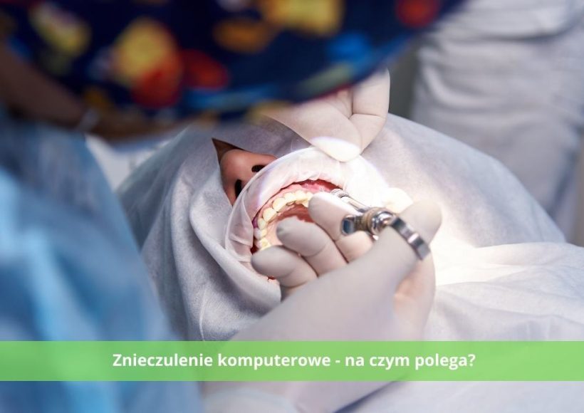 Na czym polega znieczulenie komputerowe w gabinecie stomatologicznym
