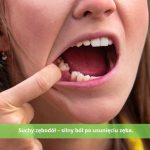 Suchy zębodół – silny ból po usunięciu zęba. Jak go rozpoznać i wyleczyć?
