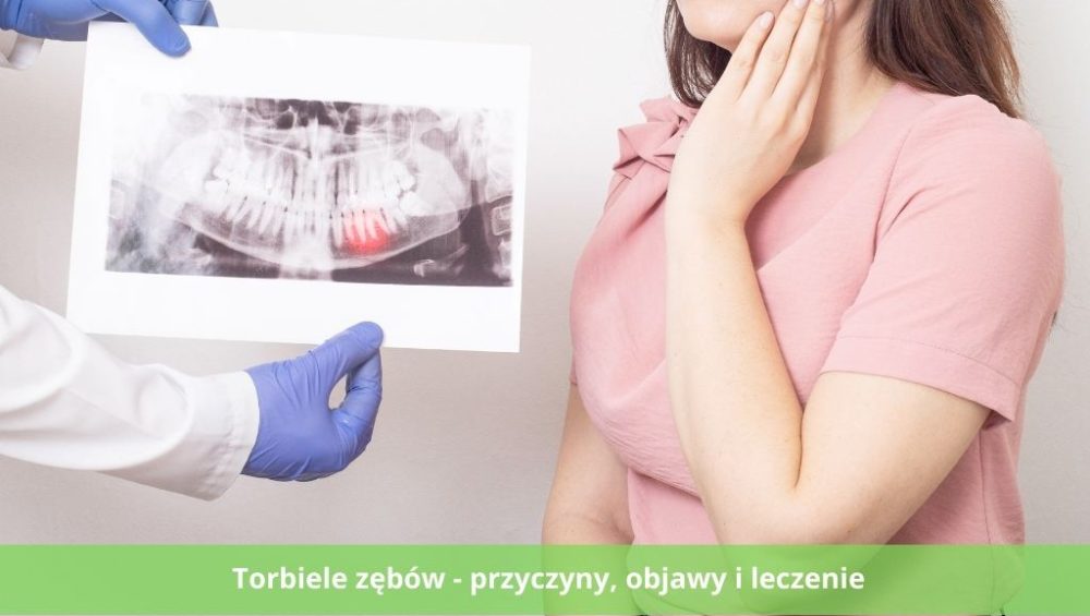 Torbiele zębów - przyczyny, objawy i leczenie