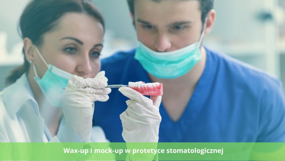 Wax-up i mock-up w protetyce stomatologicznej - czym są?