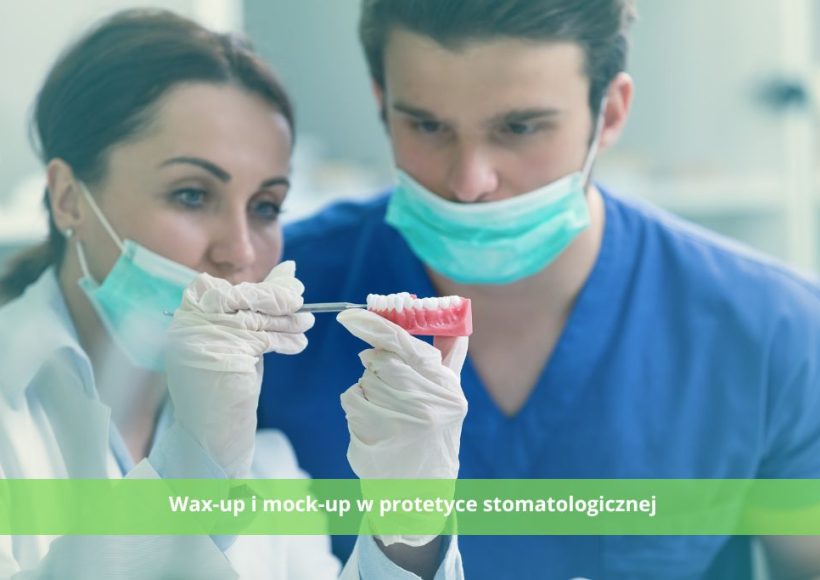 Wax-up i mock-up w protetyce stomatologicznej - czym są?