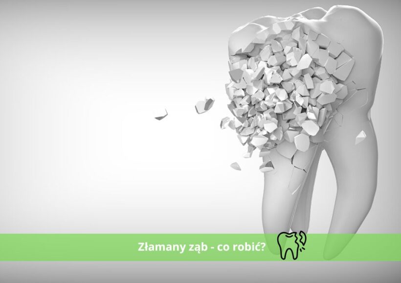 złamany ząb co robić
