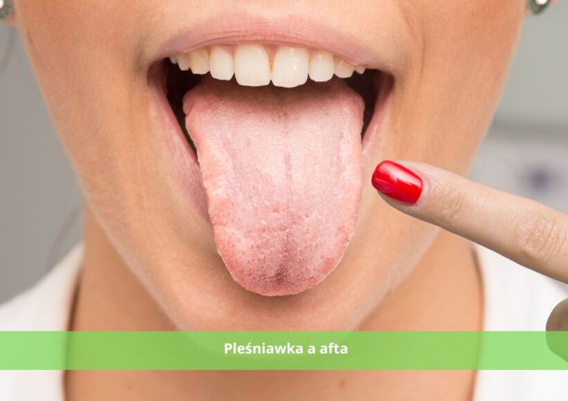 afta a pleśniawka